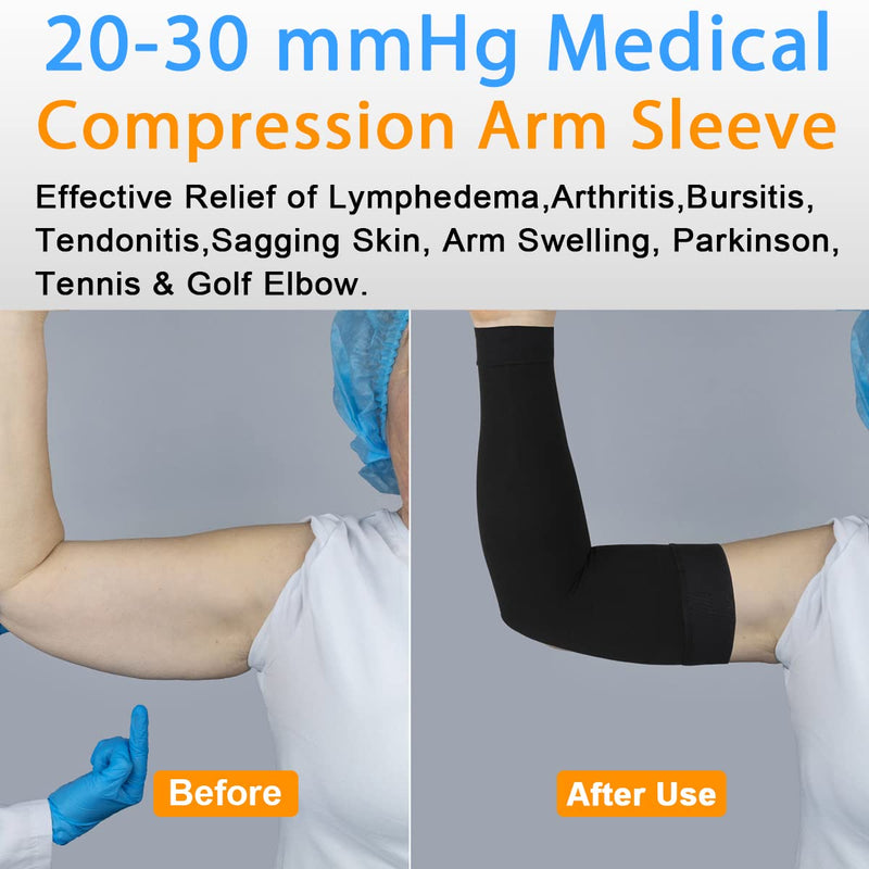Normers 20-30 mmHg Medical Lymphedema Compression Arm Sleeve for Men & Women (Single), Full Arm Support with Dot Silicone Band, Graduated Compression Arm Brace for Arthritis, Swelling, Bursitis, Dvt. Black Large - BeesActive Australia