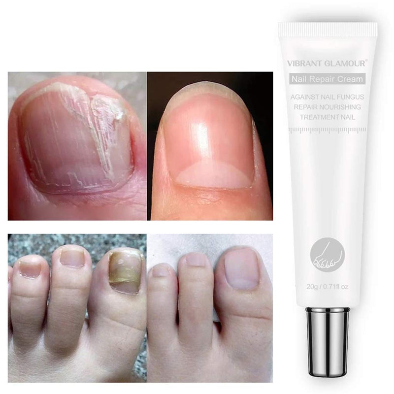 2pcs Vibrant Glamour Nail Care Nail Repair Cream Nail Fungus Treatment Onychomycosis Nail CareNail Repair Cream Nail Moisturizing, Restore Beautiful Nails - BeesActive Australia