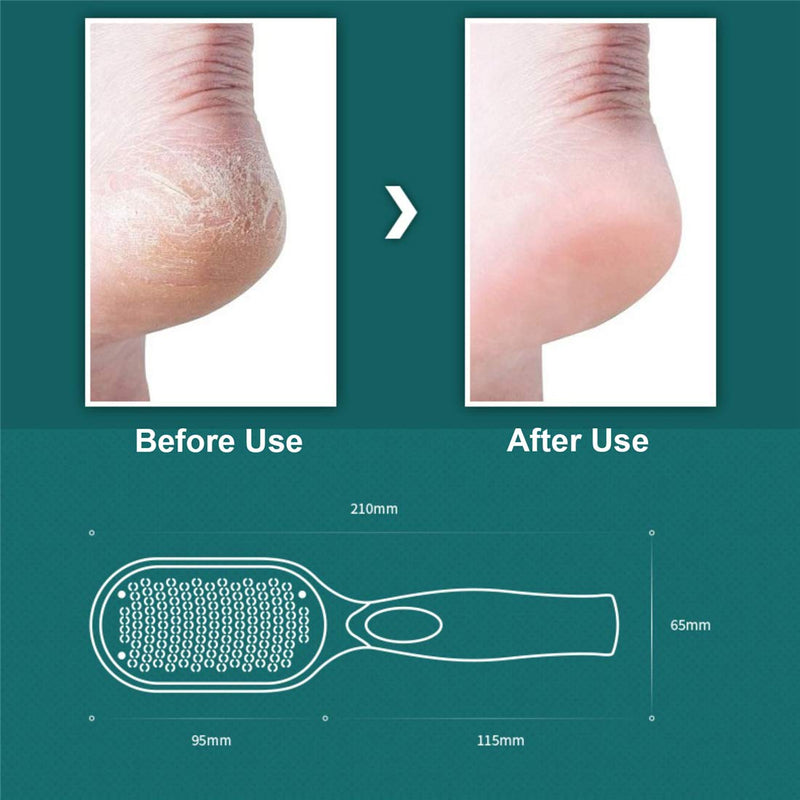 Callus Remover for Feet, Callus Scraper with Catcher, Foot File, Foot Scraper Callus Remover, Dead Skin Remover for Feet, Heel Scraper (White) White - BeesActive Australia