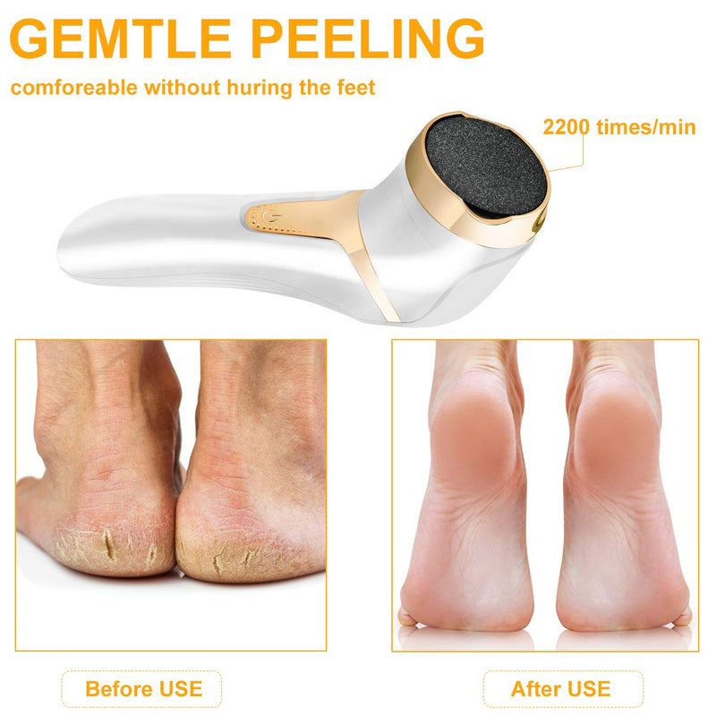 Juome Electric Foot Callus Remover, Portable Electronic Feet File Pedicure Kit, Rechargeable Callous Removers 3 Professional Electronic Feet Care Grind Head for Dead, Cracked Heels and Hard Skin - BeesActive Australia