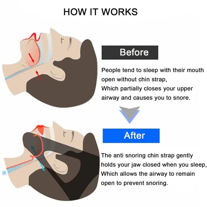 Anti Snoring Chin Strap Stop Snoring Aids Breathable Stop Snore Chin Strap Snoring Solution Snore Stopper Adjustable Anti Snoring Belt Stop Snoring Device for Men, Women, CPAP Users, Mouth Breather Black - BeesActive Australia
