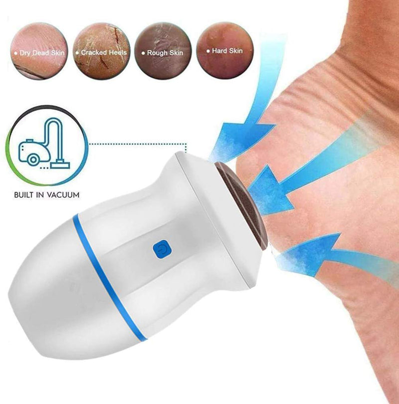 Electric Foot Grinder, Foot File Pedicure Tools, Portable USB Foot Care Dual Speed Callus Exfoliator Remover Eliminator Professional for Cracked Heels Dead Skin, Hard Cracked Dry Skin, Blue - BeesActive Australia