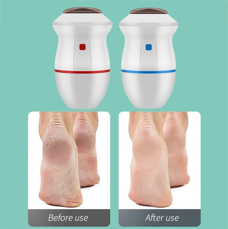 Electric Vacuum Adsorption Foot Grinder Portable Dual Speed Callus Remover For Feet Usb Dead Skin Remover For Feet (blue) blue - BeesActive Australia