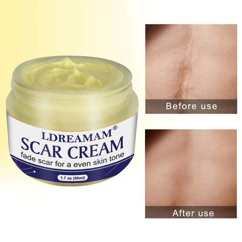 Scar Removal Cream,Skin Repair Cream,Scar Cream for C-Section,Stretch Marks,Acne,Surgery,Effective for Both Old and New Scars-50ml 50 ml - BeesActive Australia