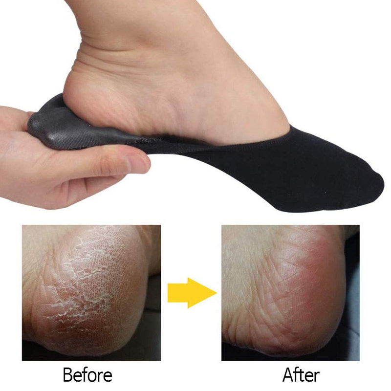 Gel No Shoe Socks – Therapeutic for Dry Cracked Feet – Relieve Heel Pain – Prevent Back Problems (Black color) Black color - BeesActive Australia