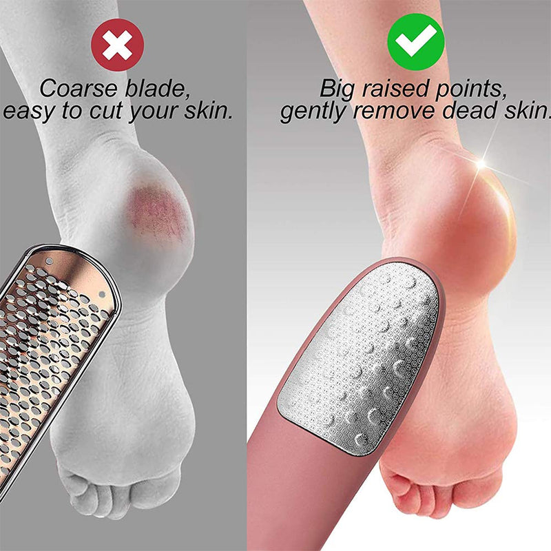 Pedicure Rasp Foot File with Holder, No-Cut Stainless Steel Foot Care with Non-Slip Handle Pedicure File to Removes Hard Skin, Can Be Used On Both Dry and Wet Feet (Foot File-Pink) Foot File-Pink - BeesActive Australia