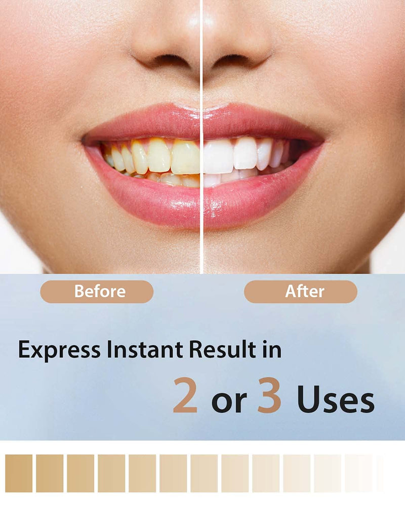 MySmile Teeth Whitening Strips, 28 White Strips Teeth Whitening Kit, Non-Sensitive 14 Sets Teeth Whitener for Tooth Whitening, Helps to Remove Smoking Coffee Soda Wine Stain, Up to 10 Shades Whiter - BeesActive Australia