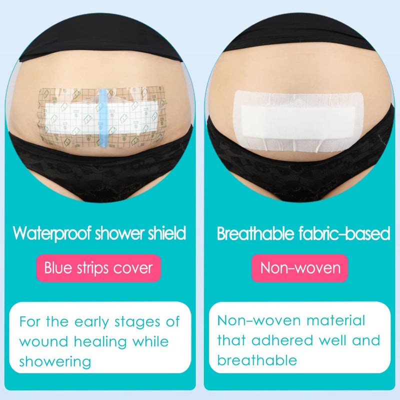 25 Pcs Waterproof C-Section Incision Shower Protector Bandage 4"x10" for Post Abdominal Surgery Hysterectomy Tummy Tuck Belly Recovery Gifts Long Surgical Incision Adhesive Wounds Cover Women Patients 4x10 Inch (Pack of 25) - BeesActive Australia