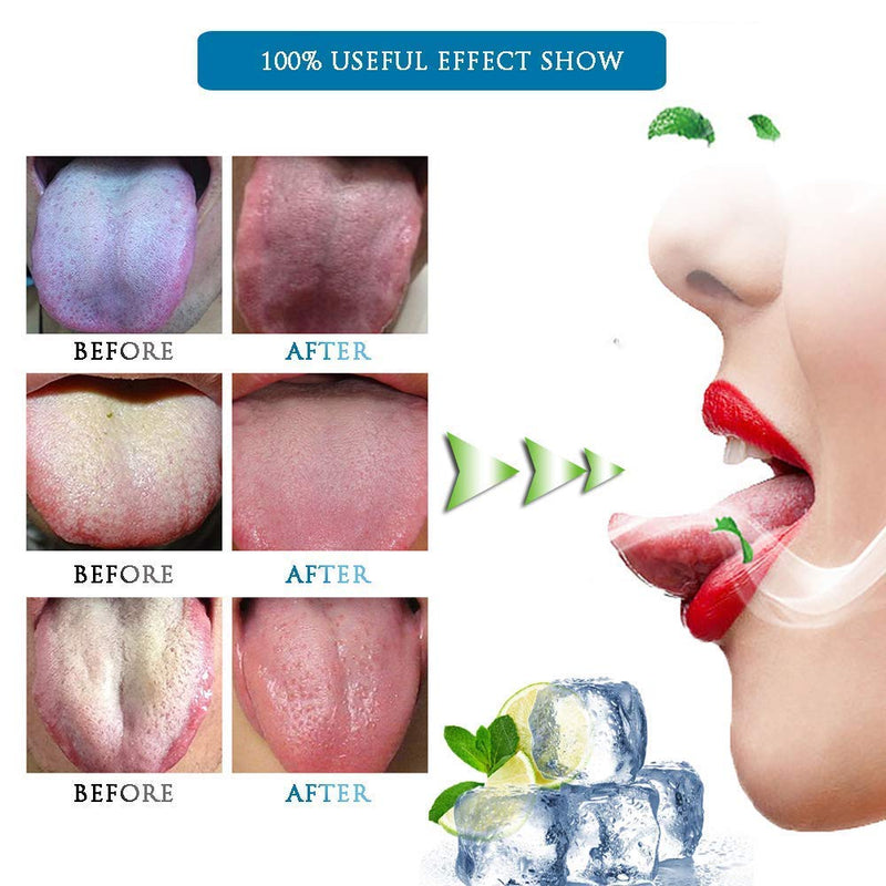 Tongue Scraper-Treatment of Dyspnea and Oral Hygiene-Tongue Cleaner Prevents Bad Breath, removes Bacteria and Natural Breath freshener (Rose Gold) - BeesActive Australia