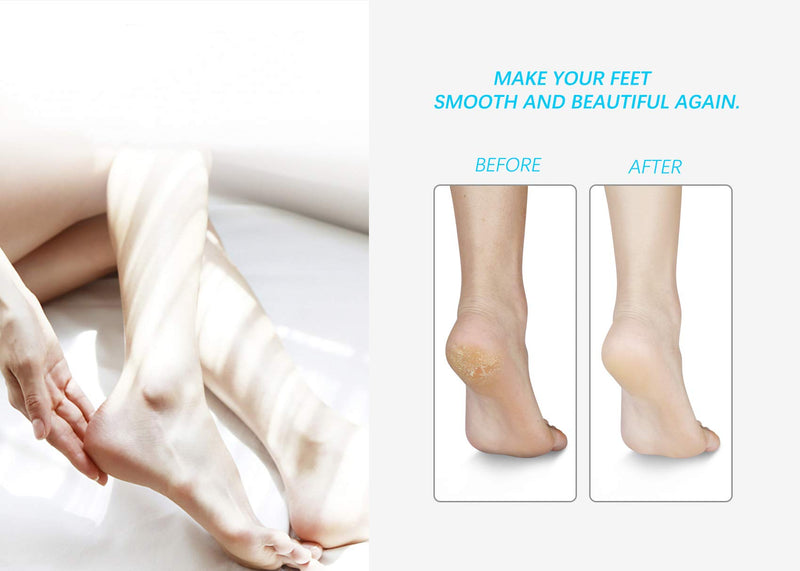 Nano Crystal Glass Foot Scrubber Hard Skin Removal,Foot File Callus Remover for Feet,Pedicure Tools Can be Used on Wet,Dry and Cracking Feet. - BeesActive Australia