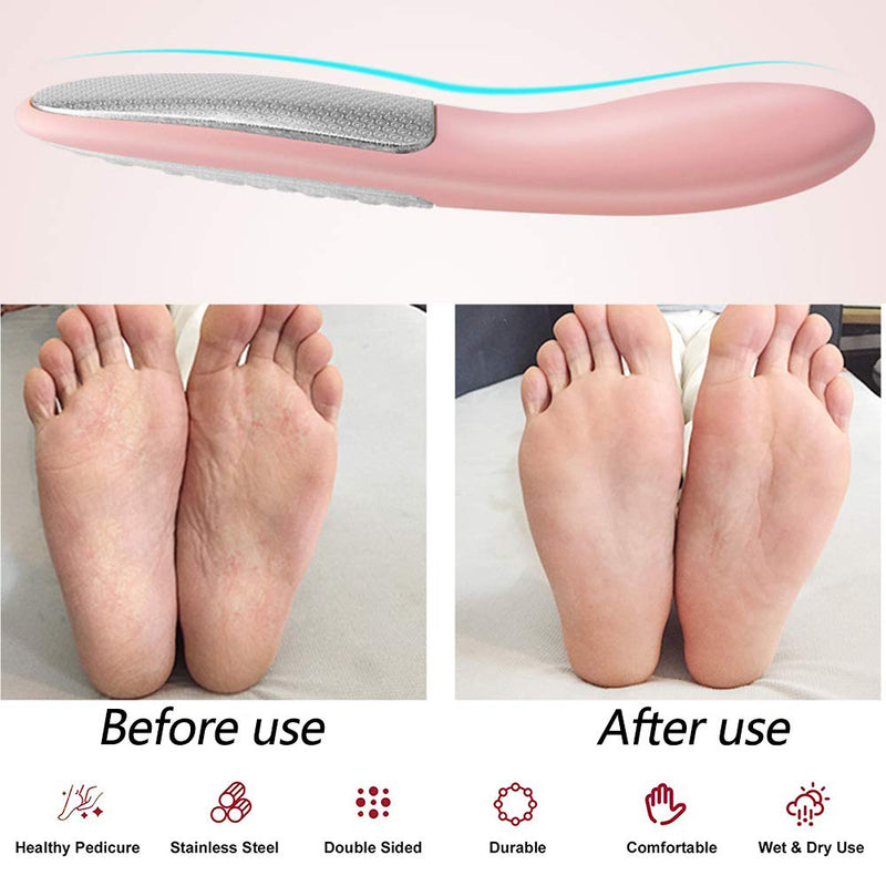 Pedicure Rasp Foot File with Holder, No-Cut Stainless Steel Foot Care with Non-Slip Handle Pedicure File to Removes Hard Skin, Can Be Used On Both Dry and Wet Feet (Foot File-Pink) Foot File-Pink - BeesActive Australia