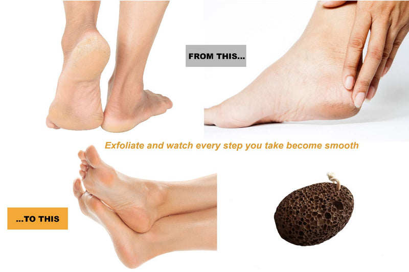 Pumice Stone for feet, Natural Earth Lava Pumice Stone, Callus Remover, Exfoliation for feet, Pedicure and Foot Scrub Tool by Synclaire Beauty - BeesActive Australia