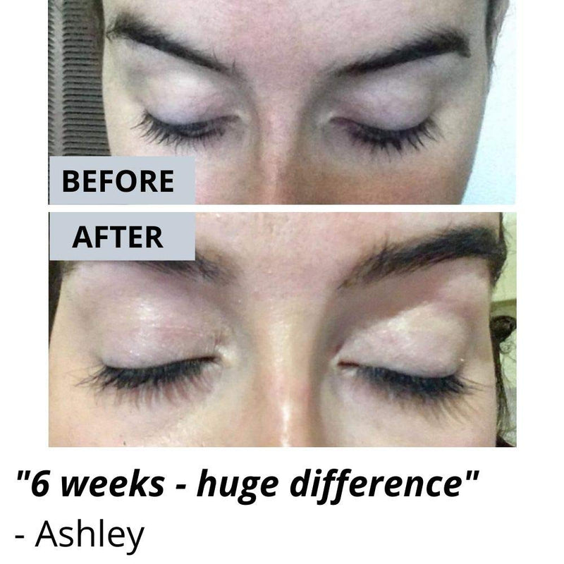 Vera Botanics Lash & Brow Booster Serum Gives You Longer Fuller Thicker Looking Eyelashes & Eyebrows. Bestselling Conditioner Stimulates The Appearance Of Growth & Regrowth. Natural Eye Lash Enhancer - BeesActive Australia
