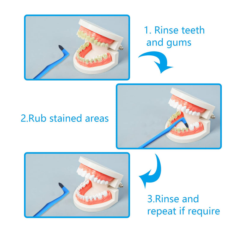 NITAIUN 5 Pieces Remover Tooth Cleaning, Teeth Stain Eraser Teeth Polishing Cleaning Kit Whitening Cleaning Eraser Oral Hygiene Care Tool (5) - BeesActive Australia
