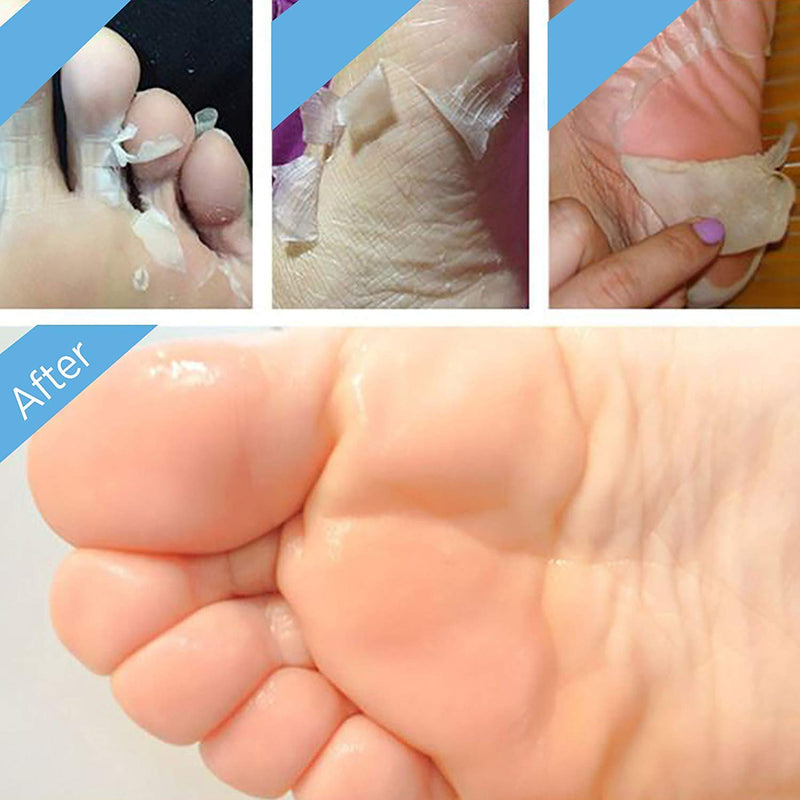2 Pairs Foot Peel Mask Exfoliant for Soft Feet in 1-2 Weeks, Exfoliating Booties for Peeling Off Calluses & Dead Skin, For Men & Women Lavender by BEALUZ - BeesActive Australia