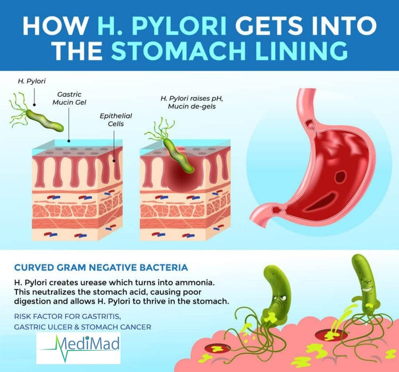 Stomach Ulcer Test Kit Helicobacter H Pylori ANTIGEN Professional Pack of 2 Tests - BeesActive Australia