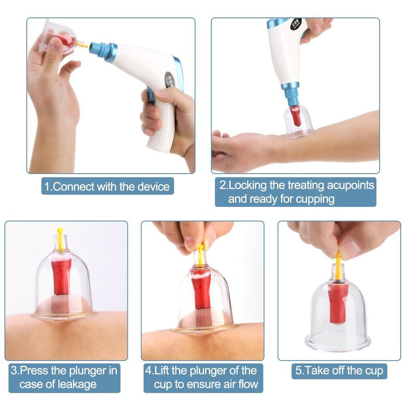 Vacuum Suction Cupping Kit, Cupping Therapy Set, Electric Vacuum Suction Cupping Kit Lymph Drainage Pain Relief Massage Cupping Set Health Care - BeesActive Australia