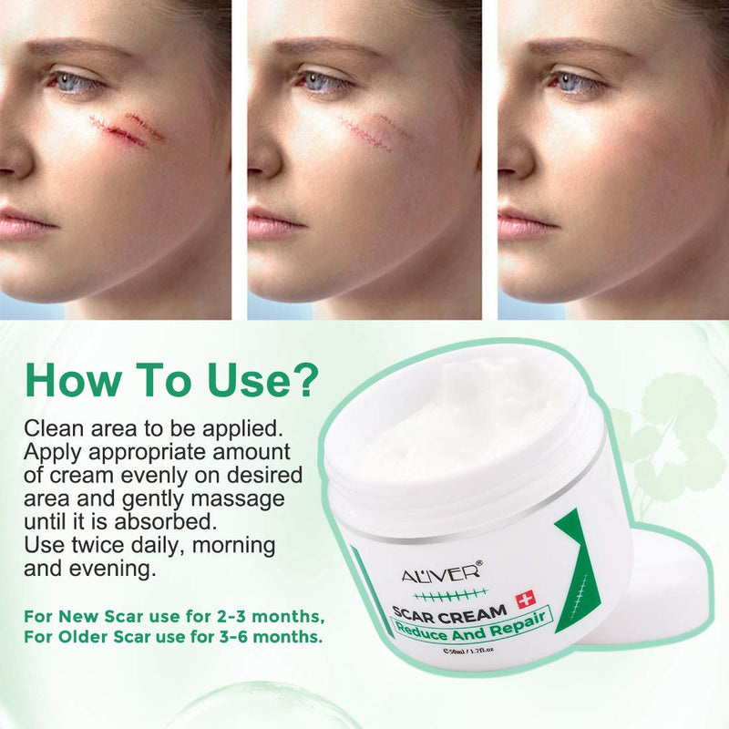 Scar Removal Cream 50G Scar Cream for Old New Scars Stretch Mark Removal Acne Spots and Burns Repair, Face Skin Repair Cream for Men & Women - BeesActive Australia