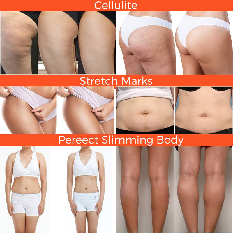 Hot Cream, Cellulite Cream for 100% Complete Cellulite Removal - Slimming Cream with Caffeine Cellulite Treatment - Body Fat Burning Weight Loss Cream for Shaping Waist, Abdomen and Buttocks - BeesActive Australia