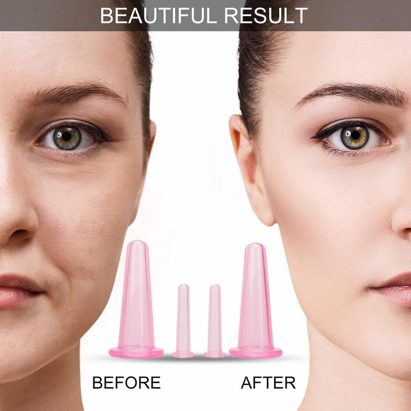 YILINNA 4 Pcs Silicone Facial Cupping Therapy Set Vacuum Massage Cup Kit Body Cupping Cup Set for Face Neck Back Eyes Massage Vacuum Cans Suction Anti Cellulite Massager Health Care (Pink) Pink - BeesActive Australia