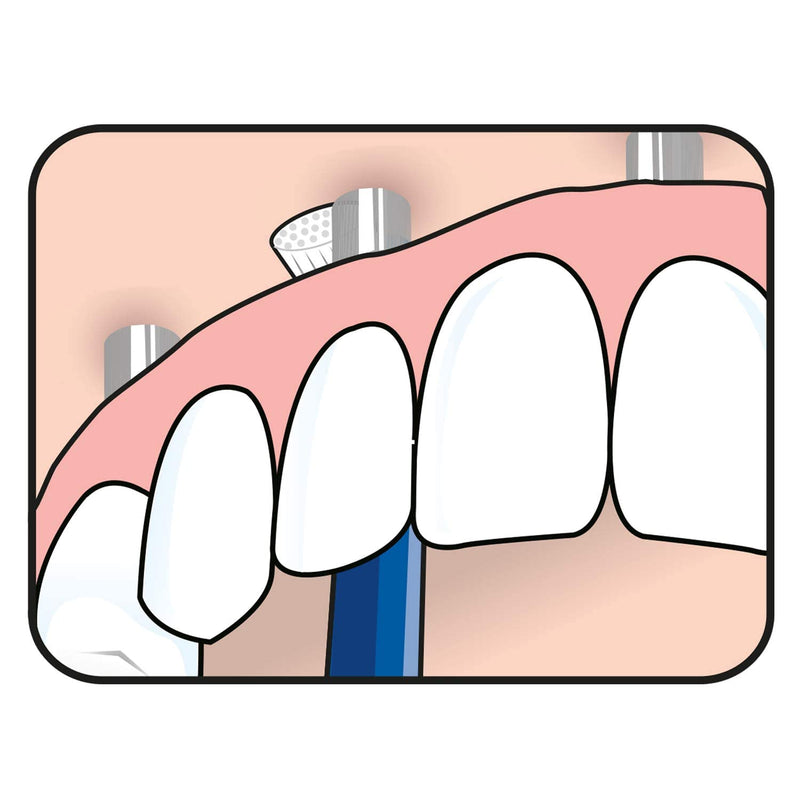 TePe Universal Care implant Brush / Innovative and unique neck design for easy implant cleaning / 1 x Implant brush - BeesActive Australia