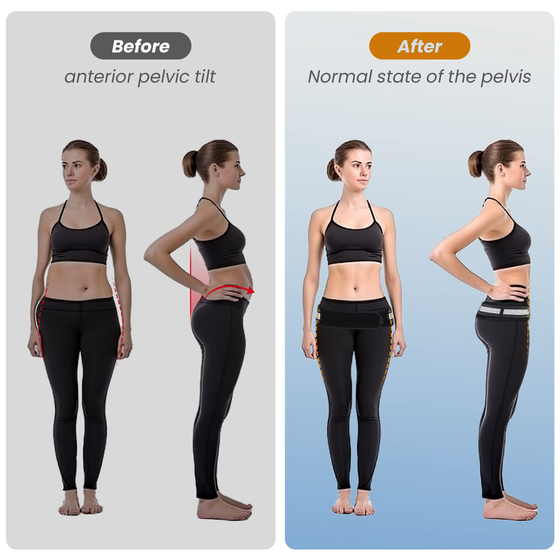 Slueat Sacroiliac SI Joint Hip Belt for Women - Hip Braces for Hip Pain - Lower Back Support Brace - Pelvic Support Belt - Trochanter Belt - Adjustable Sciatica Lumbar Pain Relief (Hip Size 32"-47") - BeesActive Australia