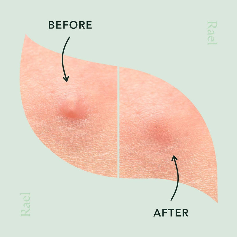 Rael Microcrystal Acne Healing Patch - Pimple Acne Spot Tea Tree Treatment (1Pack, 9 Patches) - BeesActive Australia