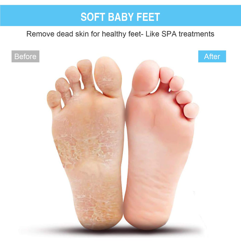 HONYIN Larger Shower Foot Scrubber, Foot Cleaner Massager Mat with Non-Slip Suction Cups - Cleans, Exfoliation, Massages Your Feet Without Bending, Foot Circulation & Relieve Tired Feet Gray - BeesActive Australia