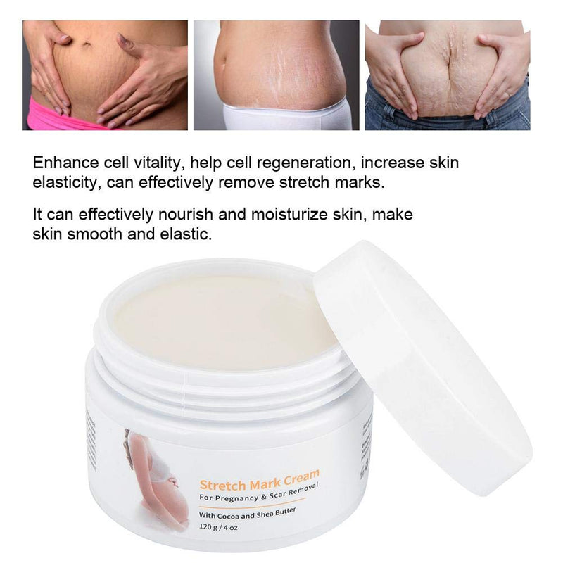 Stretch Mark Cream, Postpartum Obesity Cream, Remove Stretch Marks, Repair Scar Slack Line Abdomen Stretch Marks Postpartum 120g - BeesActive Australia