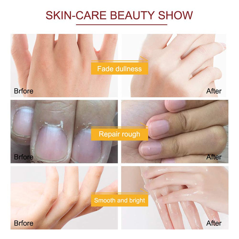 Hand Moisturizing Mask, (5 Pack) Honey and Milk Gloves, Moisturizing Natural Therapy Gloves, for Dry Aging Cracked Hands Repair Rough Skin for Men Women honey mask - BeesActive Australia