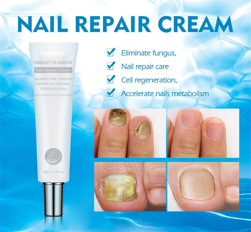 2pcs Vibrant Glamour Nail Care Nail Repair Cream Nail Fungus Treatment Onychomycosis Nail CareNail Repair Cream Nail Moisturizing, Restore Beautiful Nails - BeesActive Australia