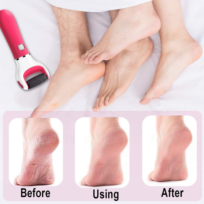 ENERBRIDGE Electric Foot File Callus Remover Pedicure File for Hard Cracked Dry Dead Skin with 2 Roller Heads-Red Red - BeesActive Australia