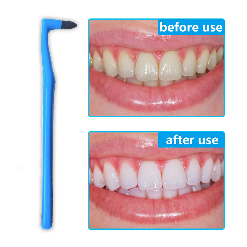 NITAIUN 5 Pieces Remover Tooth Cleaning, Teeth Stain Eraser Teeth Polishing Cleaning Kit Whitening Cleaning Eraser Oral Hygiene Care Tool (5) - BeesActive Australia