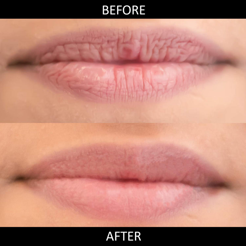 Omorfee 100% Organic Hydrating Lip Balm for Dry Cracked Chapped Lips Repair & Treatment- 10 g/0.35 Oz - BeesActive Australia