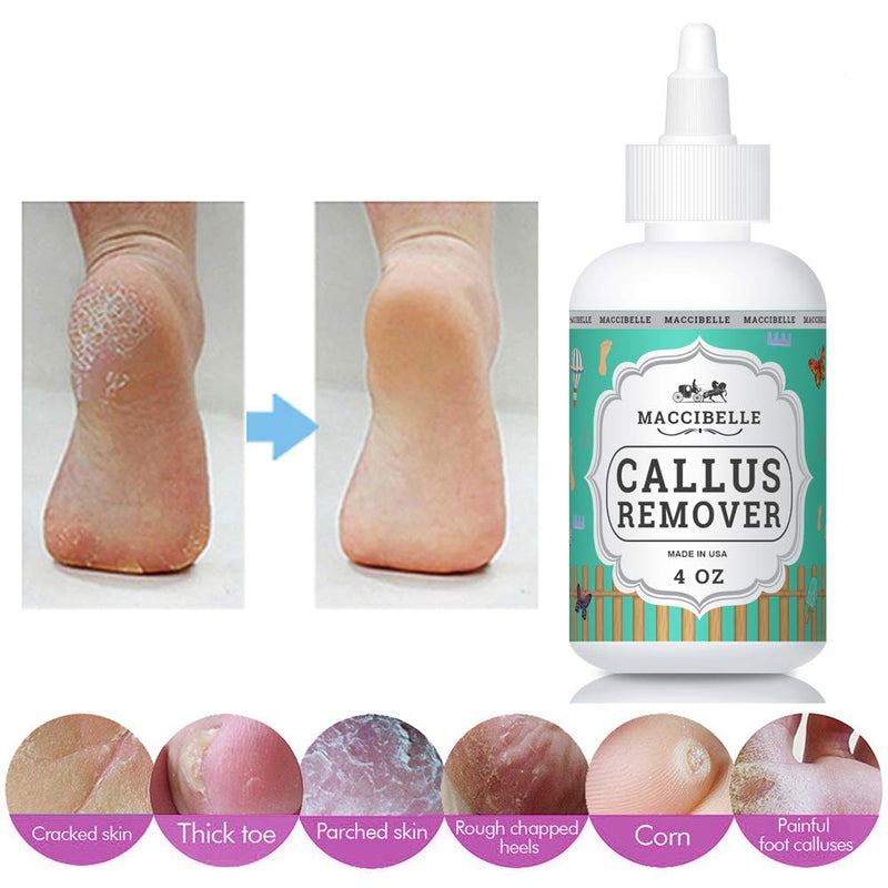 Maccibelle Callus Remover EXTRA STRENGTH For Feet, Professional Callus and Corn Eliminator Liquid Gel 4 oz Pack of 1 - BeesActive Australia