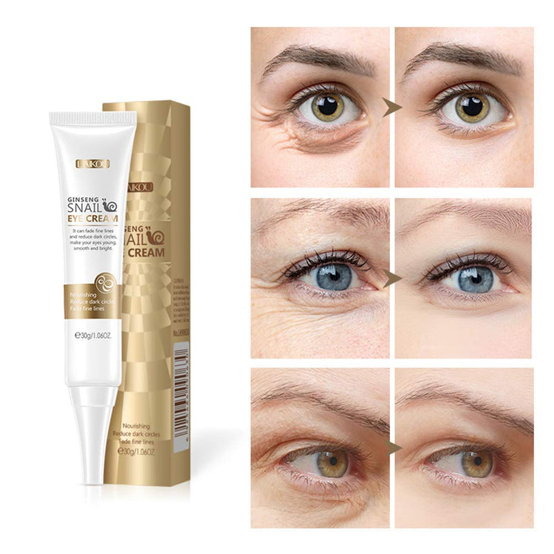 Snail Eye Cream Nourishing Reduce Dark Circles Essence Fade Lines Anti-Puffiness Anti-Aging Moisturizing - BeesActive Australia