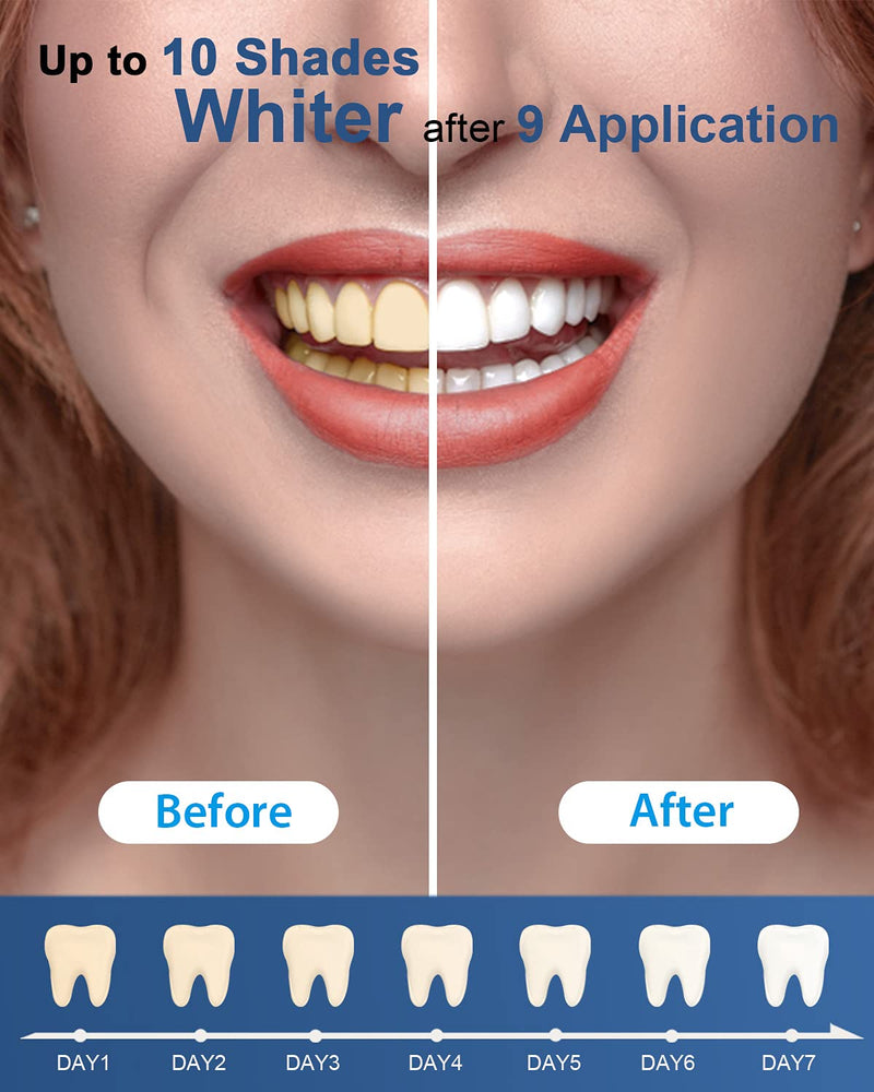 MySmile Teeth Whitening Kit, Non-Sensitive Teeth Whitener Kit with 3 Teeth Whitening Gel & Light, 10 Min Fast-Result Home Tooth Whitening Dental Care Help Remove Teeth Stain from Coffee,Peroxide Free - BeesActive Australia