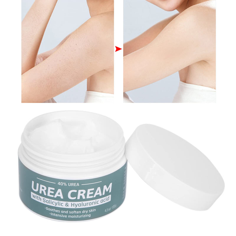 Intensive Foot Cream For Cracked Heels and Dry Skin - Urea Cream For Foot Care & Athletes Foot Treatment - Cracked Heel Repair Cream 120g - BeesActive Australia