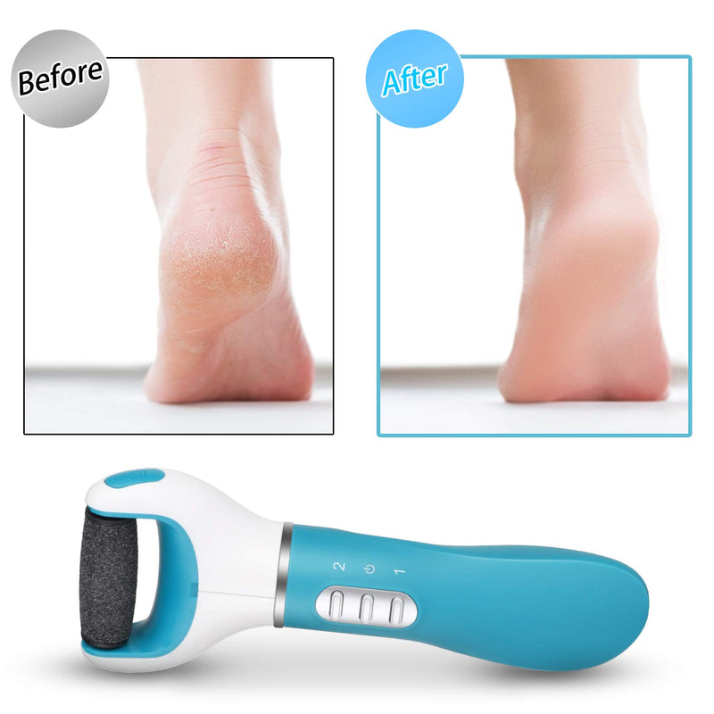 DMH Callus Remover for Feet, Portable Electronic Foot File Pedicure Tool, Dead Skin Remover for Feet, with 3 Rollers and 1 Cleaning Brush, Rechargeable (Blue) - BeesActive Australia