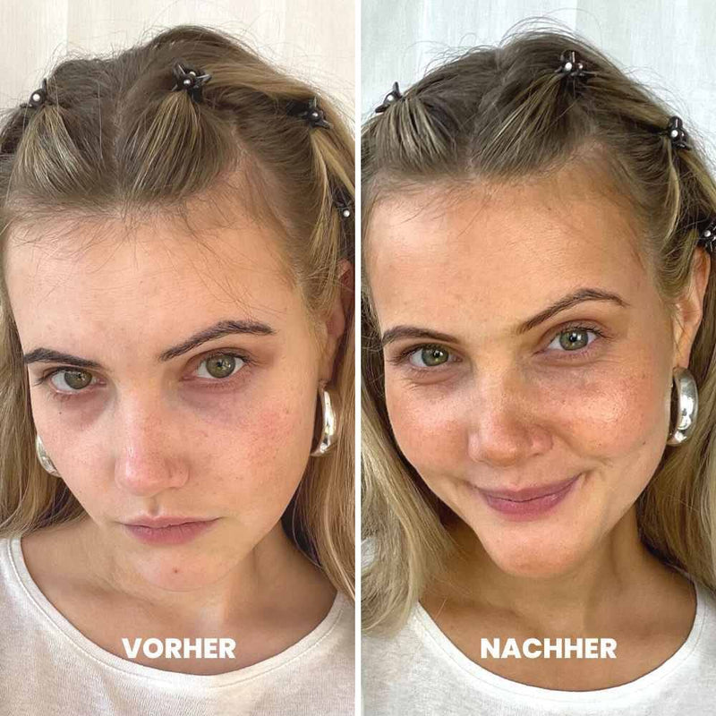 VENICEBODY Hyaluronic Self Tan Drops | Made in Germany | Self Tanner Face | concentrate to mix into facial care with anti-aging effect, for an individual tan - BeesActive Australia