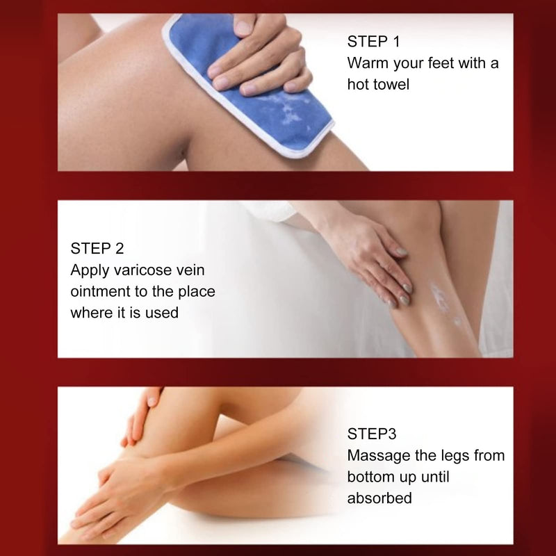 Varicose Veins Cream, Professional Varicose Vein Treatment Calf Muscle Cream, for Legs Relief Phlebitis 80g - BeesActive Australia