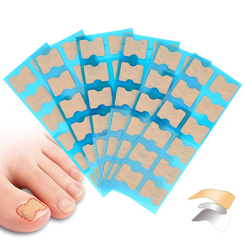 Ingrown Toenail Sticker, Ingrown Toenail Correction Patch Ingrown Toenail Tools Professional Foot Care Tool (70 pcs) 70 Pcs - BeesActive Australia