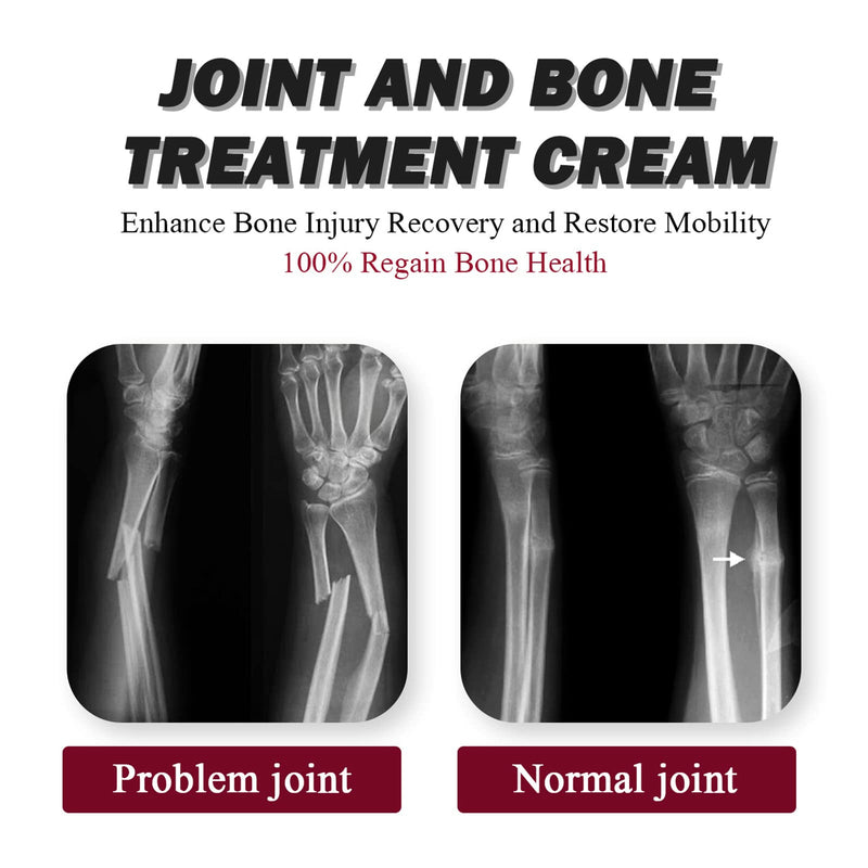 Joint Therapy Cream,Joint Bone Cream,Muscle Recovery Cream,Make Bone Stronger&Enhance Bone Mobility - BeesActive Australia