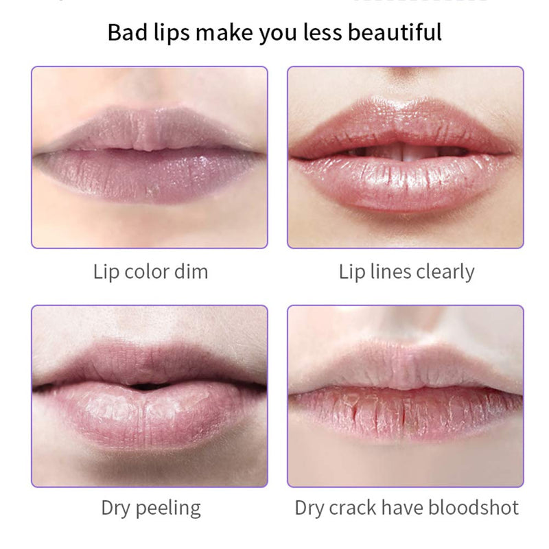 Honey Lip Mask, Lip Masks for Dry Lips, Day and Night Repair The Lip Color Fade Lip Lines Hydrating Prevention Dry and Crack Lipstick Raincoat, Sleeping Lip Mask (honey for day use) honey for day use - BeesActive Australia
