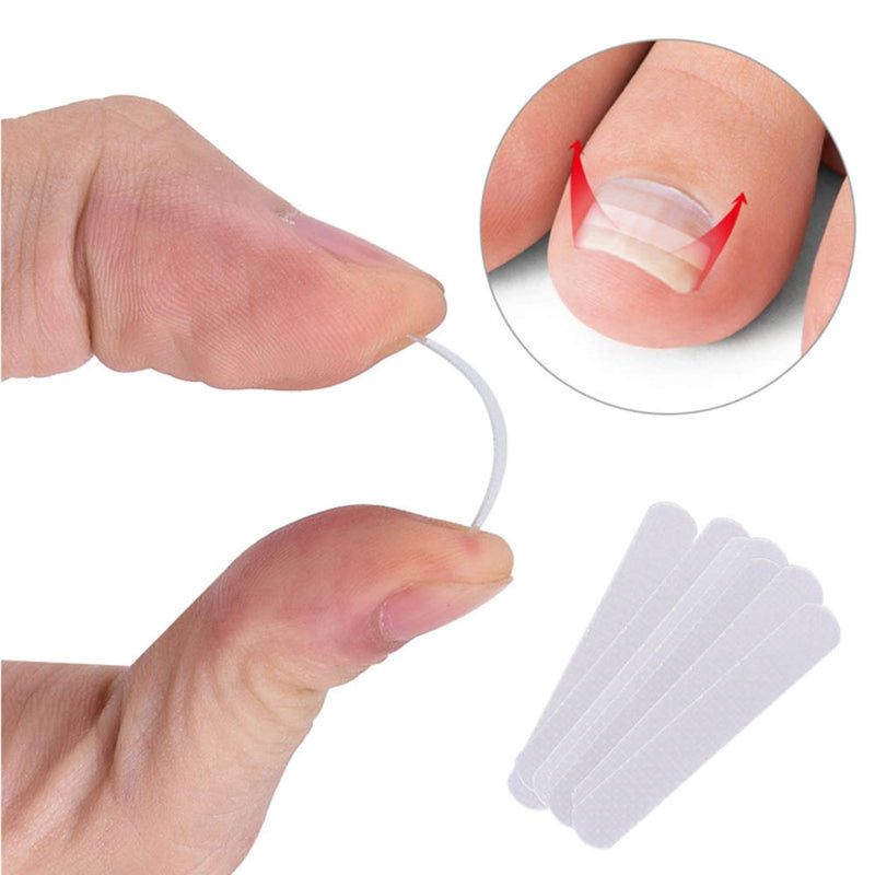 ONNPNN 50 Pieces Ingrown Toenail Correction Patches, Ingrown Toe Nail Treatment Tool, Curved Toenails Straightening Recover Clip, Thick Paronychia Correction Pedicure Tool - BeesActive Australia