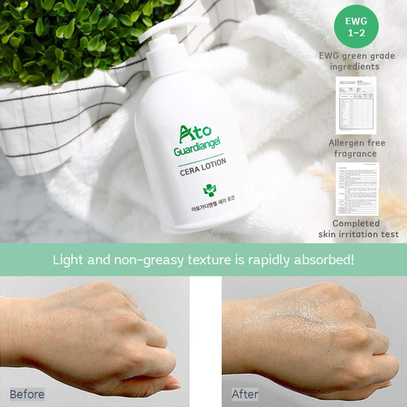 Atoguardiangel Cera Lotion for Eczema, Dry - Sensitive Skin Allergen-Free Steroid-Free Lotion, Dermatologist Reviewed, Clinically Tested 10.14 oz - BeesActive Australia