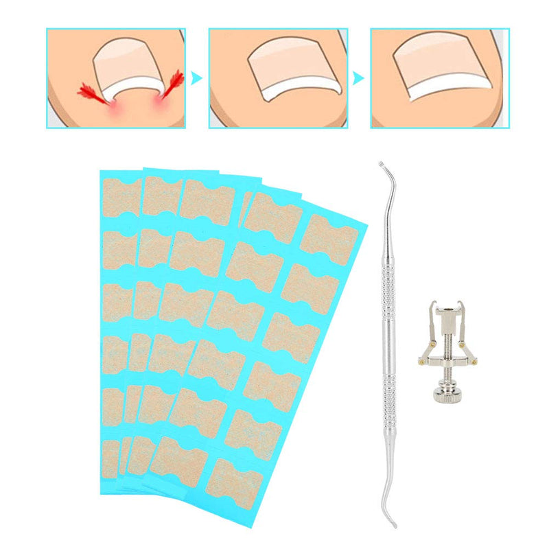 Mild Painless Toenail Correction Patch, Pedicure Ingrown Nail Corrector, Professional for Men Women Ingrown Nail Toenail Care Tool(48 pieces) 48 pieces - BeesActive Australia