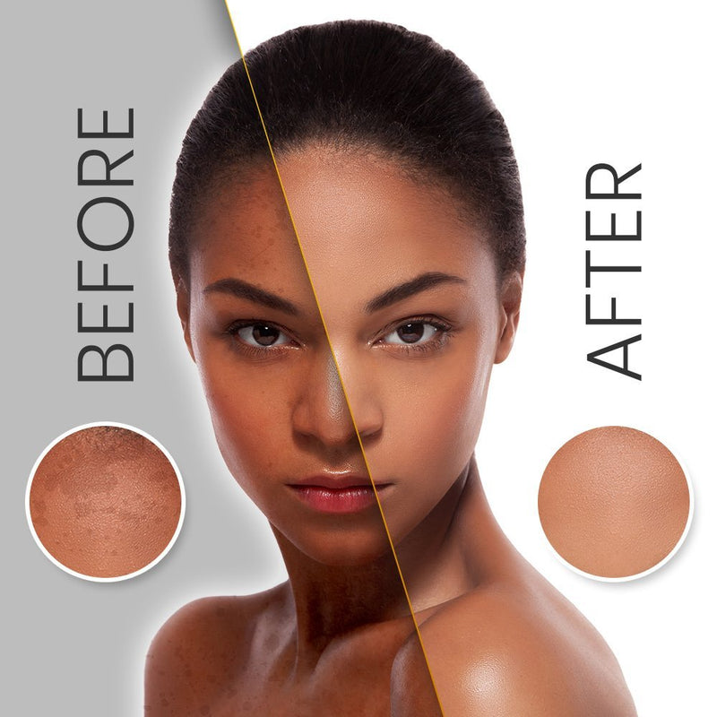 Makari Extreme Carrot & Argan Oil Facial Toning FACE Gel 1.0oz –Lightening, Brightening & Tightening Gel with Organiclarine –Whitening & Anti-Aging Treatment for Dark Spots, Acne Scars & Wrinkles - BeesActive Australia