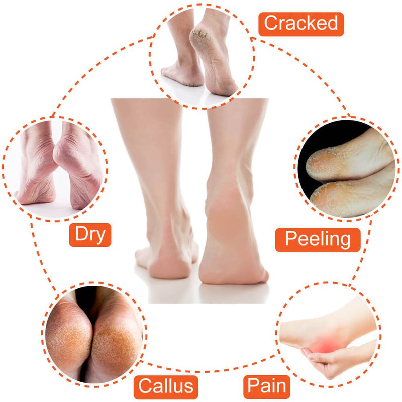 Selizo 5 Pairs Moisturizing Gel Heel Socks Open Toe Socks for Dry Hard Cracked Heels, 5 Colors - BeesActive Australia