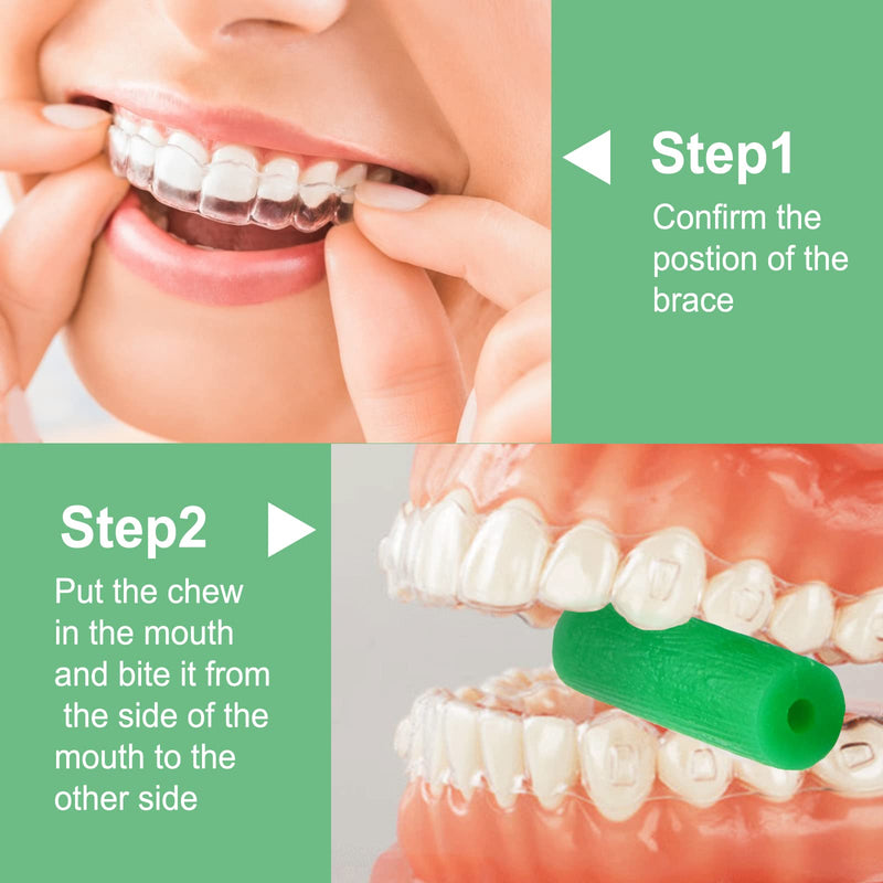 10 Pieces BVN Aligner Chewies for Aligner Chompers Aligner Trays Seater, Orthodontic Dental Chewies, Mint Scent Green 10 Pieces Aligner Chewies - BeesActive Australia